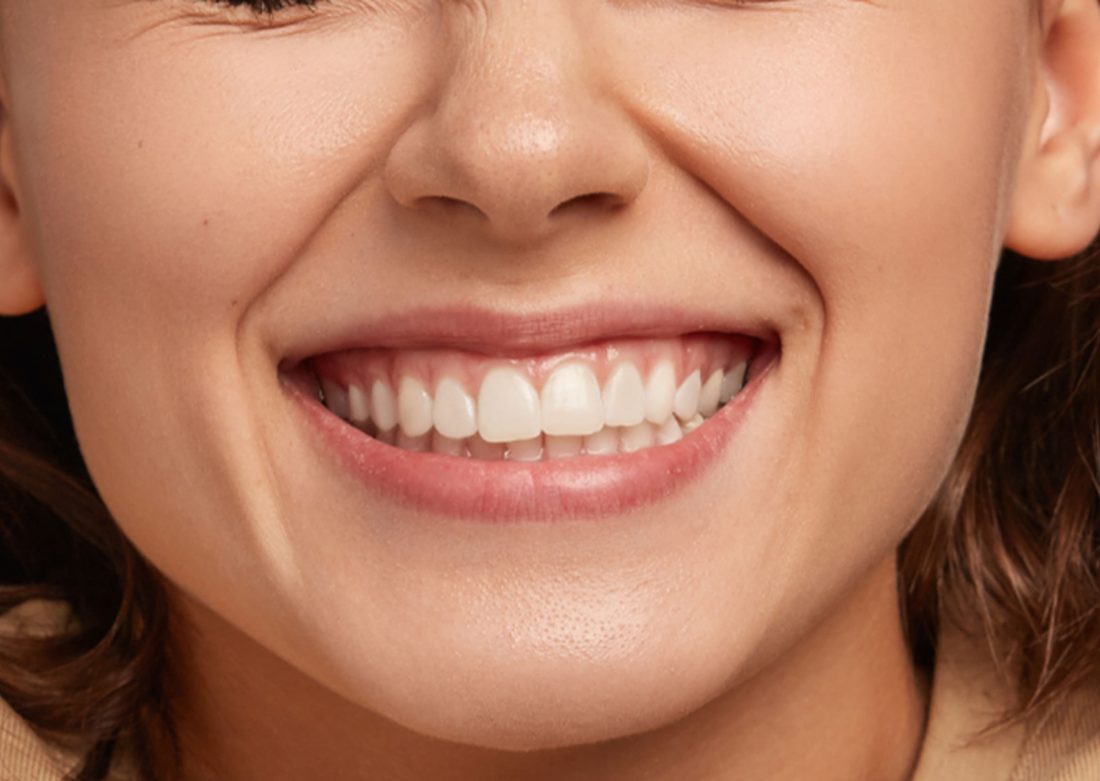 Emergency Dental Visits
