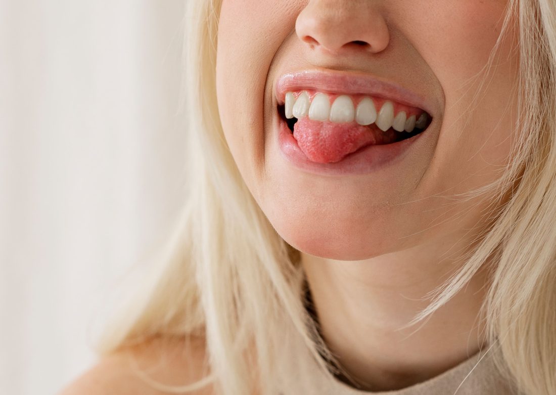 Frenectomy